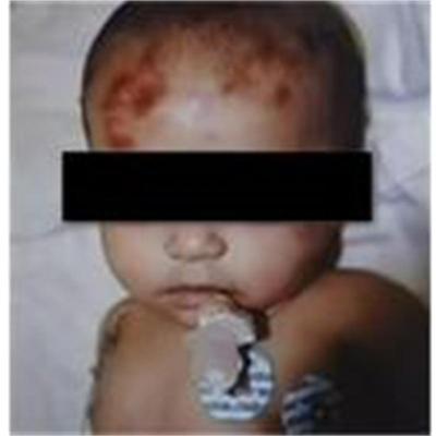 2-годишният йордан, пребит от мащехата си, все още е в кома