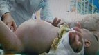 2 - годишно дете в китай роди със секцио близнака си